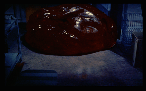 1958 Blob at doctor.